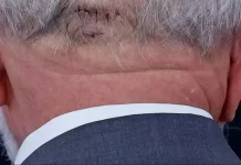 Lula deve enfrentar novo procedimento médico na noite desta quinta-feira