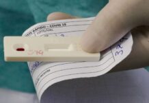 Diagnóstico de Covid longa passa despercebido nos serviços de saúde