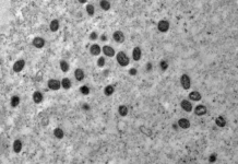 Equipe do Ministério da Saúde investiga cepa de mpox em SP