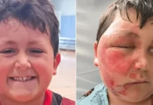 Menino de 9 anos fica gravemente ferido ao imitar desafio viral do TikTok