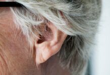 Sinal de Frank: cardiologista do Humap-UFMS esclarece mitos e verdades