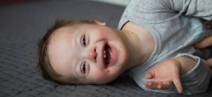 Curso gratuito apoia famílias e profissionais no cuidado à pessoa com Síndrome de Down_6a471a6852b7c.jpeg