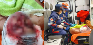 Idoso tem rosto dilacerado após ataque de cachorro