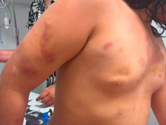 Mãe de menina espancada pelo padrasto na fronteira cobrou dinheiro para devolver a filha_6a62c915eb463.jpeg