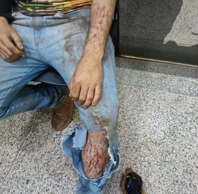 Com arranhões, operador de colheitadeira diz que foi atacado por onça em lavoura_6a7fca1ec792f.jpeg