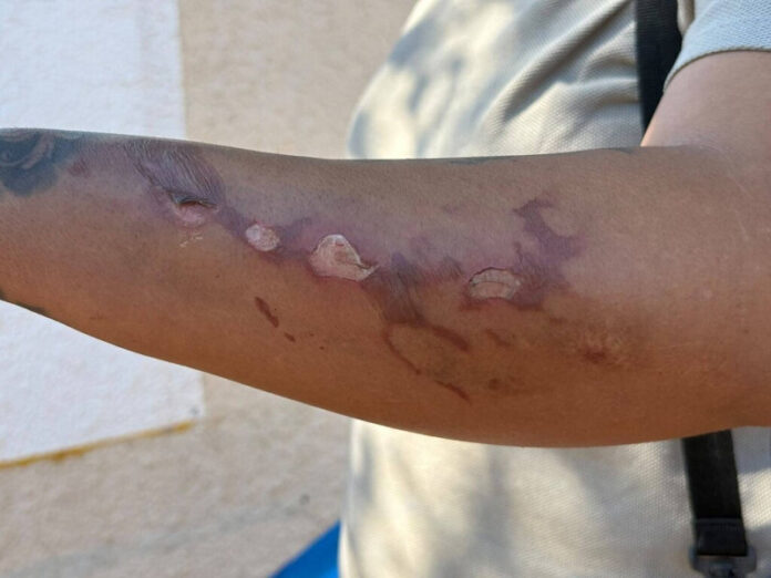 Mãe quebra o silêncio após tragédia e revela como explosão matou filho de 3 anos_6a6eaa860743f.jpeg