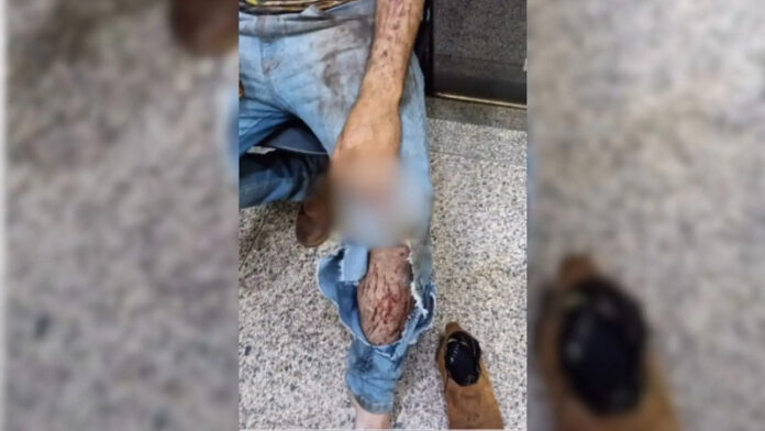 Trabalhador diz ter sido atacado por onça durante colheita em Nova Itamarati_6a7fcb70113fe.jpeg